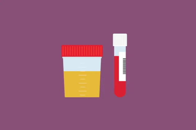 Why Confidential STD STI Testing Matters